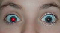 Free Red-eye Reduction Tool 2.0